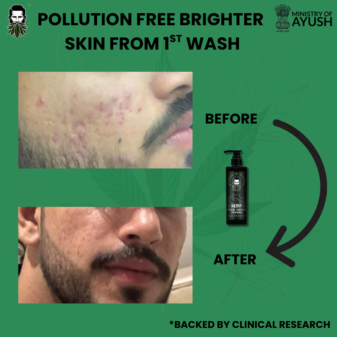 The Ultimate Hemp Combo - Face Wash & Shampoo