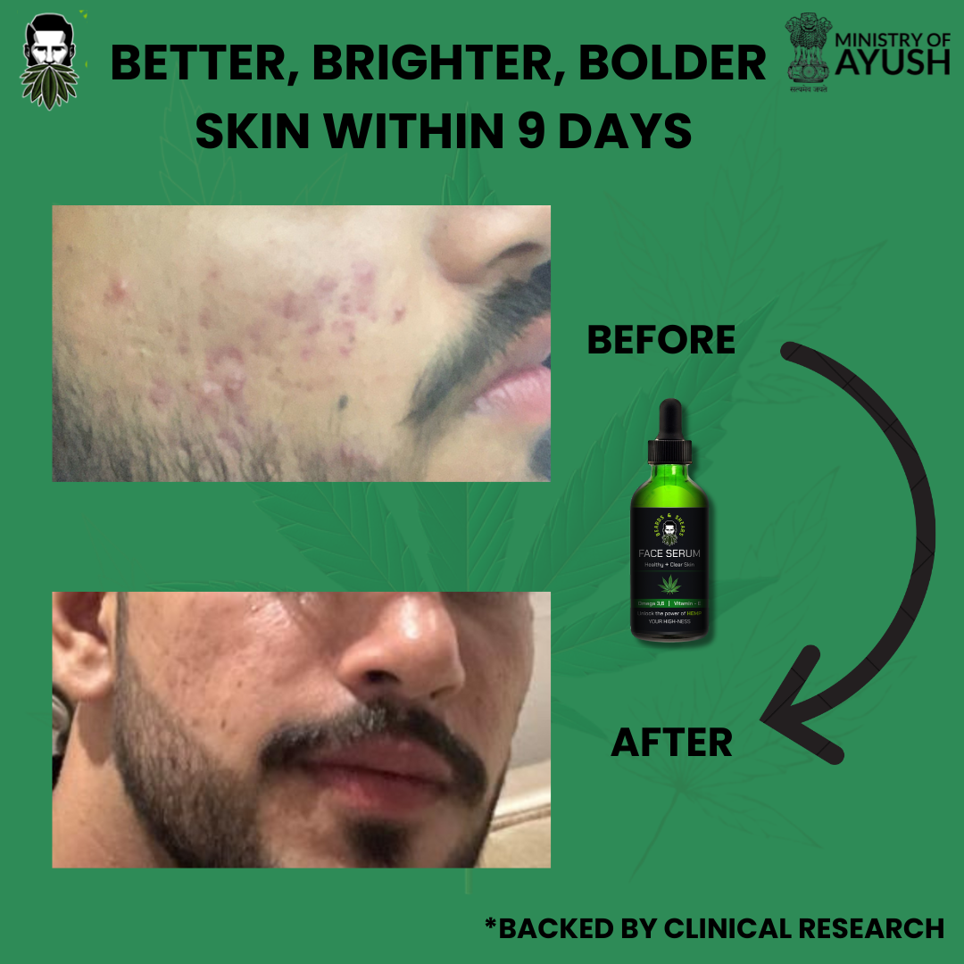 Hemp Face Serum | For a Better, Brighter & Bolder Skin - 30ml