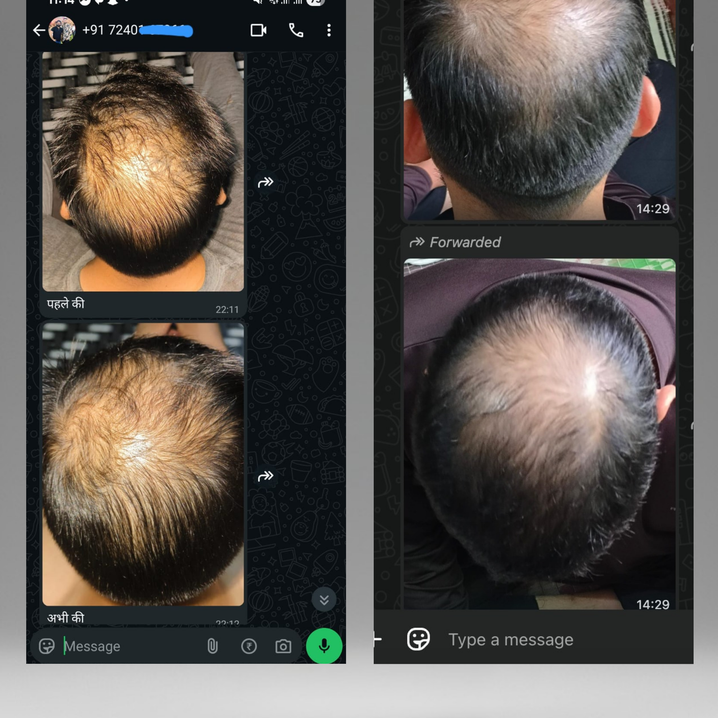 Hair Growth 30 Days | Stage 1