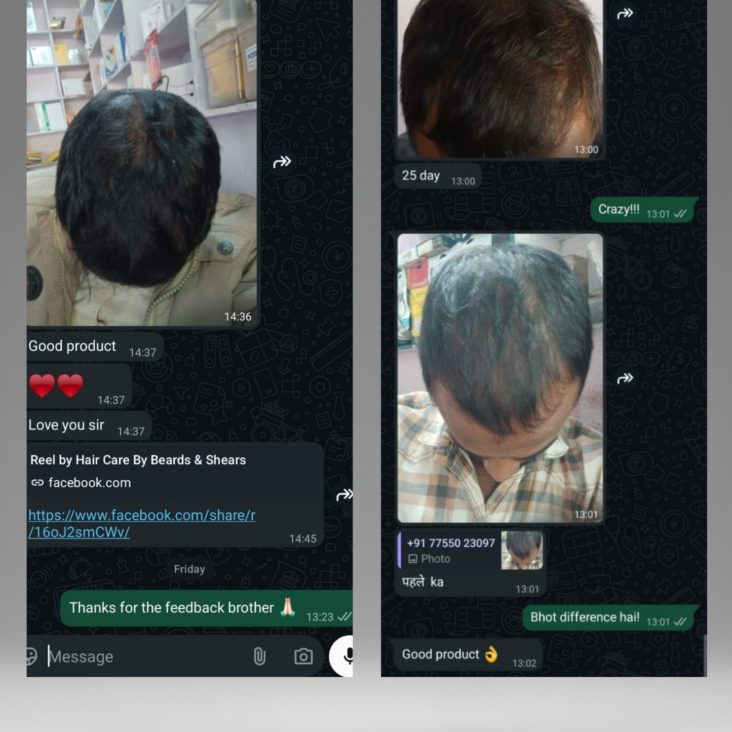 The Fu*k OFF Dandruff Combo - Eliminates Dandruff & Regrows Hair in 6 weeks