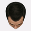 Stage 1