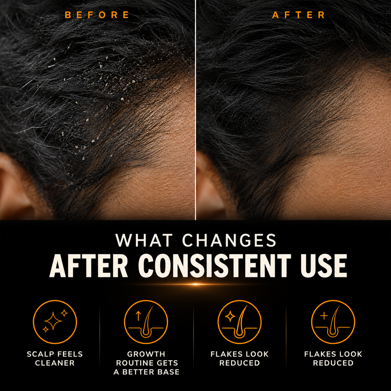 Anti Dandruff & Hair Growth Combo | Piroctone Olamine Shampoo + Minoxidil Hair Serum