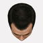 Stage 2