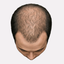 Stage 3