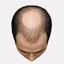 Stage 4