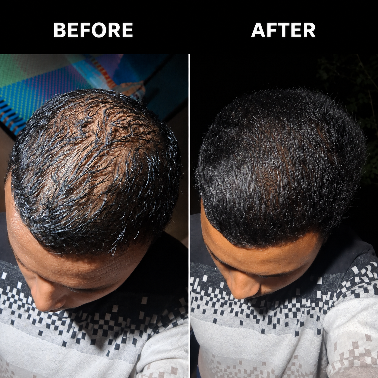 Hair Growth 30 Days | Stage 1